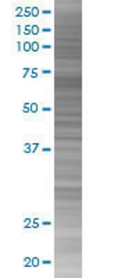 F11 transfected lysate.