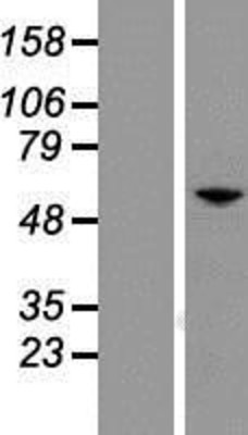 Western Blot: PAX7 Overexpression Lysate (Adult Normal) [NBP2-08096] Left-Empty vector transfected control cell lysate (HEK293 cell lysate); Right -Over-expression Lysate for PAX7.