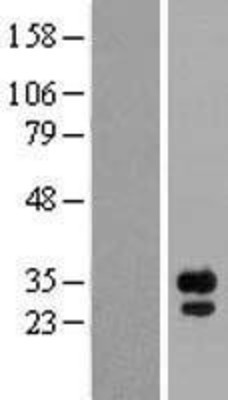 Western Blot: FGF14 Overexpression Lysate (Adult Normal) [NBP2-05047] Left-Empty vector transfected control cell lysate (HEK293 cell lysate); Right -Over-expression Lysate for FGF14.