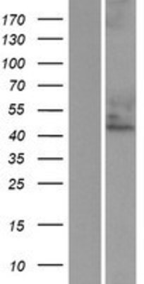 Western Blot: Cytohesin 3 Overexpression Lysate (Adult Normal) [NBP2-10577] Left-Empty vector transfected control cell lysate (HEK293 cell lysate); Right -Over-expression Lysate for Cytohesin 3.