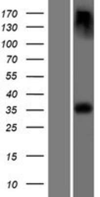 Western Blot: Laforin Overexpression Lysate (Adult Normal) [NBP2-10449] Left-Empty vector transfected control cell lysate (HEK293 cell lysate); Right -Over-expression Lysate for Laforin.
