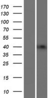 Western Blot: B3GNT4 Overexpression Lysate (Adult Normal) [NBP2-06192] Left-Empty vector transfected control cell lysate (HEK293 cell lysate); Right -Over-expression Lysate for B3GNT4.