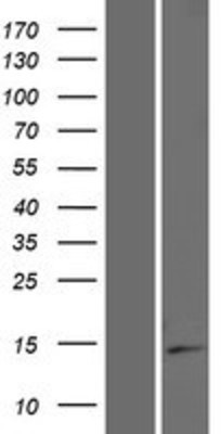 Western Blot: ISOC2 Overexpression Lysate (Adult Normal) [NBP2-09608] Left-Empty vector transfected control cell lysate (HEK293 cell lysate); Right -Over-expression Lysate for ISOC2.