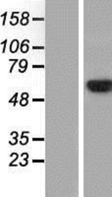 Western Blot: GRB10 Overexpression Lysate (Adult Normal) [NBP2-08984] Left-Empty vector transfected control cell lysate (HEK293 cell lysate); Right -Over-expression Lysate for GRB10.