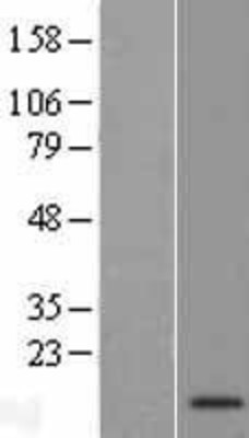 Western Blot: C9orf170 Overexpression Lysate (Adult Normal) [NBP2-08950] Left-Empty vector transfected control cell lysate (HEK293 cell lysate); Right -Over-expression Lysate for C9orf170.