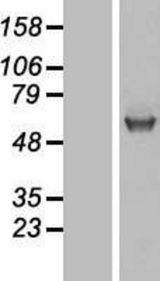 Western Blot: UGT1A1 Overexpression Lysate (Adult Normal) [NBP2-09025] Left-Empty vector transfected control cell lysate (HEK293 cell lysate); Right -Over-expression Lysate for UGT1A1.