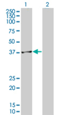Lane 1: RFC3 transfected lysate (40.6 KDa). Lane 2: Non-transfected lysate.