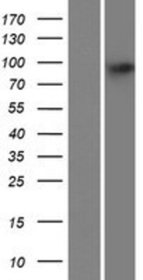 Western Blot: PARP8 Overexpression Lysate (Adult Normal) [NBP2-06315] Left-Empty vector transfected control cell lysate (HEK293 cell lysate); Right -Over-expression Lysate for PARP8.