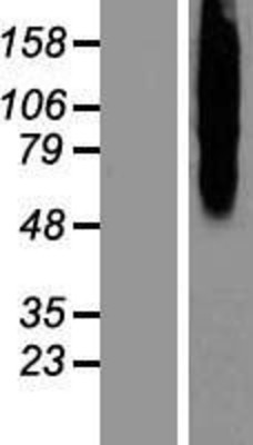 Western Blot: Calcitonin receptor Overexpression Lysate (Adult Normal) [NBP2-11483] Left-Empty vector transfected control cell lysate (HEK293 cell lysate); Right -Over-expression Lysate for Calcitonin receptor.