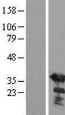 Western Blot: SGTA Overexpression Lysate (Adult Normal) [NBL1-15915] Left-Empty vector transfected control cell lysate (HEK293 cell lysate); Right -Over-expression Lysate for SGTA.