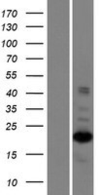 Western Blot: ZNF268 Overexpression Lysate (Adult Normal) [NBP2-10224] Left-Empty vector transfected control cell lysate (HEK293 cell lysate); Right -Over-expression Lysate for ZNF268.