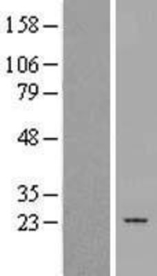 Western Blot: PTGES2 Overexpression Lysate (Adult Normal) [NBP2-10087] Left-Empty vector transfected control cell lysate (HEK293 cell lysate); Right -Over-expression Lysate for PTGES2.