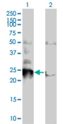 Lane 1: BNIP1 transfected lysate (25.19 KDa). Lane 2: Non-transfected lysate.