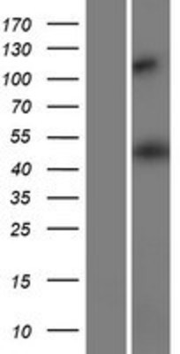 Western Blot: HMGCS2 Overexpression Lysate (Adult Normal) [NBP2-10151] Left-Empty vector transfected control cell lysate (HEK293 cell lysate); Right -Over-expression Lysate for HMGCS2.