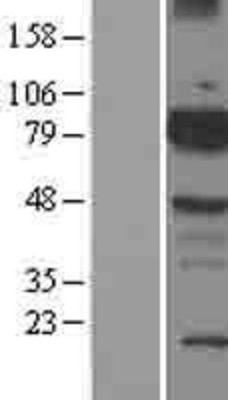 Western Blot: BMX Overexpression Lysate (Adult Normal) [NBP2-10119] Left-Empty vector transfected control cell lysate (HEK293 cell lysate); Right -Over-expression Lysate for BMX.