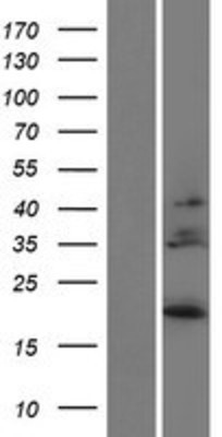 Western Blot: IL28B Overexpression Lysate (Adult Normal) [NBP2-05198] Left-Empty vector transfected control cell lysate (HEK293 cell lysate); Right -Over-expression Lysate for IL28B.