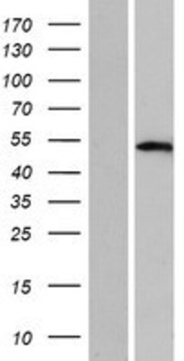 Western Blot: TFAP2D Overexpression Lysate (Adult Normal) [NBP2-05173] Left-Empty vector transfected control cell lysate (HEK293 cell lysate); Right -Over-expression Lysate for TFAP2D.