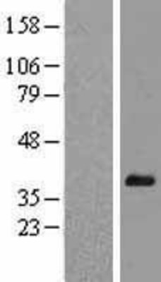 Western Blot: Hey L Overexpression Lysate (Adult Normal) [NBL1-11523] Left-Empty vector transfected control cell lysate (HEK293 cell lysate); Right -Over-expression Lysate for Hey L.