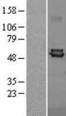 Western Blot: Ferredoxin Reductase Overexpression Lysate (Adult Normal) [NBL1-10672] Left-Empty vector transfected control cell lysate (HEK293 cell lysate); Right -Over-expression Lysate for Ferredoxin Reductase.