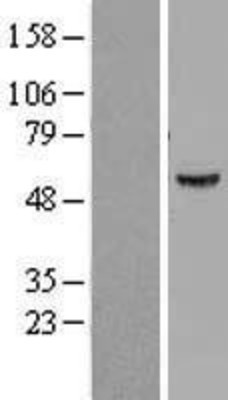 Western Blot: ATP6V1B1 Overexpression Lysate (Adult Normal) [NBL1-07838] Left-Empty vector transfected control cell lysate (HEK293 cell lysate); Right -Over-expression Lysate for ATP6V1B1.