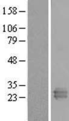 Western Blot: REXO2 Overexpression Lysate (Adult Normal) [NBL1-15291] Left-Empty vector transfected control cell lysate (HEK293 cell lysate); Right -Over-expression Lysate for REXO2.