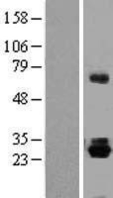 Western Blot: Thyrotropin Releasing Hormone Overexpression Lysate (Adult Normal) [NBP2-10383] Left-Empty vector transfected control cell lysate (HEK293 cell lysate); Right -Over-expression Lysate for Thyrotropin Releasing Hormone.