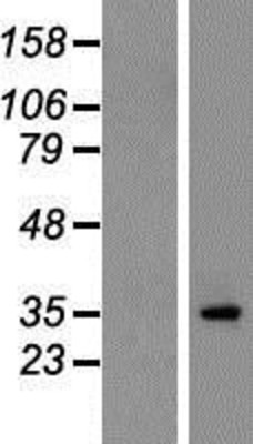 Western Blot: Stargazin Overexpression Lysate (Adult Normal) [NBP2-10433] Left-Empty vector transfected control cell lysate (HEK293 cell lysate); Right -Over-expression Lysate for Stargazin.