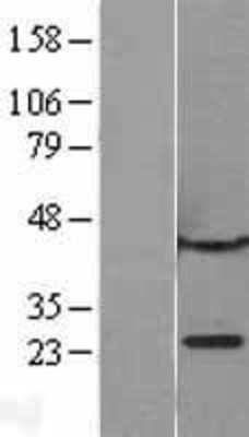 Western Blot: CBX1 Overexpression Lysate (Adult Normal) [NBP2-09436] Left-Empty vector transfected control cell lysate (HEK293 cell lysate); Right -Over-expression Lysate for CBX1.
