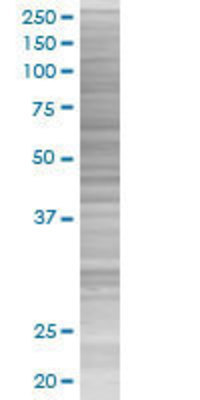 NTRK2 transfected lysate.