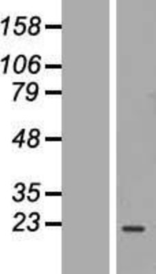 Western Blot: Calpain 3 Overexpression Lysate (Adult Normal) [NBP2-05153] Left-Empty vector transfected control cell lysate (HEK293 cell lysate); Right -Over-expression Lysate for Calpain 3.