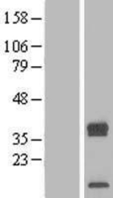 Western Blot: TRAM2 Overexpression Lysate (Adult Normal) [NBL1-17254] Left-Empty vector transfected control cell lysate (HEK293 cell lysate); Right -Over-expression Lysate for TRAM2.