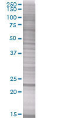TPD52L1 transfected lysate