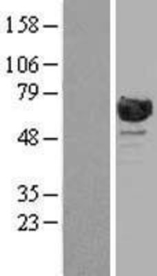 Western Blot: RanGAP1 Overexpression Lysate (Adult Normal) [NBL1-15144] Left-Empty vector transfected control cell lysate (HEK293 cell lysate); Right -Over-expression Lysate for RanGAP1.