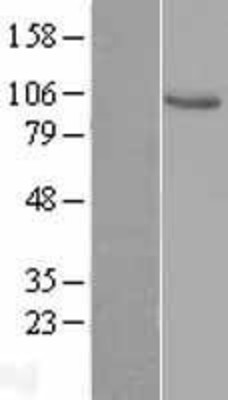 Western Blot: VAV1 Overexpression Lysate (Adult Normal) [NBL1-17701] Left-Empty vector transfected control cell lysate (HEK293 cell lysate); Right -Over-expression Lysate for VAV1.
