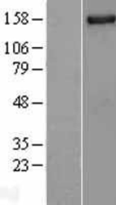 Western Blot: NUP155 Overexpression Lysate (Adult Normal) [NBL1-13872] Left-Empty vector transfected control cell lysate (HEK293 cell lysate); Right -Over-expression Lysate for NUP155.