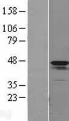 Western Blot: Actin Alpha 2 Smooth Muscle Overexpression Lysate (Adult Normal) [NBL1-07272] Left-Empty vector transfected control cell lysate (HEK293 cell lysate); Right -Over-expression Lysate for Actin Alpha 2 Smooth Muscle.