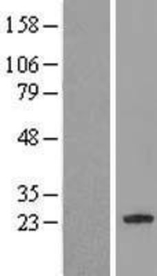 Western Blot: C7orf61 Overexpression Lysate (Adult Normal) [NBL1-12606] Left-Empty vector transfected control cell lysate (HEK293 cell lysate); Right -Over-expression Lysate for C7orf61.