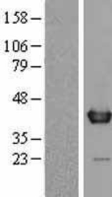Western Blot: WDR5 Overexpression Lysate (Adult Normal) [NBL1-17816] Left-Empty vector transfected control cell lysate (HEK293 cell lysate); Right -Over-expression Lysate for WDR5.