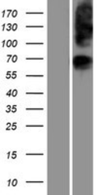 Western Blot: glycerol-3-phosphate permease Overexpression Lysate (Adult Normal) [NBP2-06750] Left-Empty vector transfected control cell lysate (HEK293 cell lysate); Right -Over-expression Lysate for glycerol-3-phosphate permease.