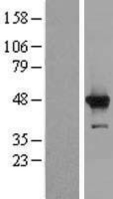 Western Blot: C3orf37 Overexpression Lysate (Adult Normal) [NBP2-06680] Left-Empty vector transfected control cell lysate (HEK293 cell lysate); Right -Over-expression Lysate for C3orf37.