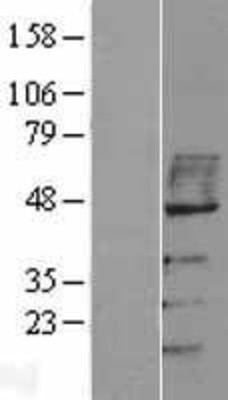 Western Blot: MAVS Overexpression Lysate (Adult Normal) [NBP2-06621] Left-Empty vector transfected control cell lysate (HEK293 cell lysate); Right -Over-expression Lysate for MAVS.