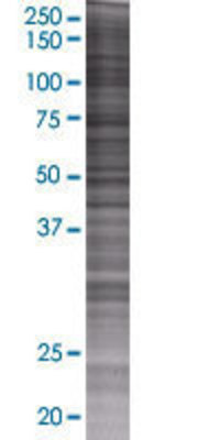 ROBO2 transfected lysate.