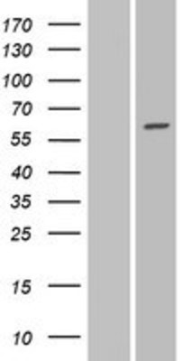 Western Blot: GALNTL1 Overexpression Lysate (Adult Normal) [NBP2-06624] Left-Empty vector transfected control cell lysate (HEK293 cell lysate); Right -Over-expression Lysate for GALNTL1.
