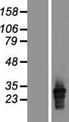 Western Blot: HLA DQA2 Overexpression Lysate (Adult Normal) [NBP2-06688] Left-Empty vector transfected control cell lysate (HEK293 cell lysate); Right -Over-expression Lysate for HLA DQA2.