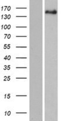 Western Blot: PITPNM2 Overexpression Lysate (Adult Normal) [NBP2-06600] Left-Empty vector transfected control cell lysate (HEK293 cell lysate); Right -Over-expression Lysate for PITPNM2.
