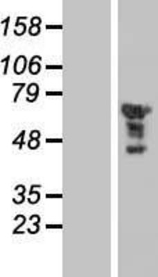 Western Blot: EGR2 Overexpression Lysate (Adult Normal) [NBP2-09603] Left-Empty vector transfected control cell lysate (HEK293 cell lysate); Right -Over-expression Lysate for EGR2.