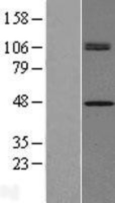 Western Blot: CHID1 Overexpression Lysate (Adult Normal) [NBP2-09668] Left-Empty vector transfected control cell lysate (HEK293 cell lysate); Right -Over-expression Lysate for CHID1.