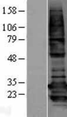 Western Blot: BCAP31 Overexpression Lysate (Adult Normal) [NBP2-09618] Left-Empty vector transfected control cell lysate (HEK293 cell lysate); Right -Over-expression Lysate for BCAP31.