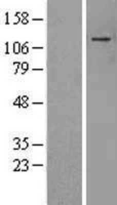 Western Blot: ADNP Overexpression Lysate (Adult Normal) [NBP2-10045] Left-Empty vector transfected control cell lysate (HEK293 cell lysate); Right -Over-expression Lysate for ADNP.