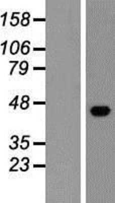 Western Blot: ESAM Overexpression Lysate (Adult Normal) [NBP2-05600] Left-Empty vector transfected control cell lysate (HEK293 cell lysate); Right -Over-expression Lysate for ESAM.